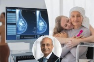 How to know if you have 'dense breasts' that increase cancer risk