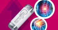 Una nueva esperanza para pacientes con artritis reumatoide