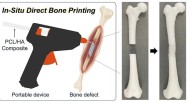 3D-Printing ‘Glue Gun’ Can Repair Bone Fractures During Surgery Filling