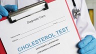 Colesterol alto: éstas son las señales clínicas que no debemos ignorar