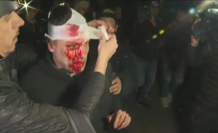 Golpearon a un periodista en el cierre de campaña de Milei en Moreno