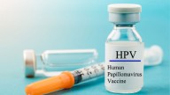 Un análisis de sangre detecta el cáncer asociado al VPH 10 años antes