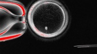 Scientists create human eggs via in vitro gametogenesis : NPR