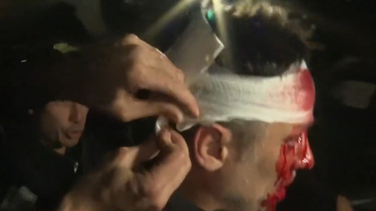 Un periodista fue gravemente herido durante el acto de Javier Milei en Moreno