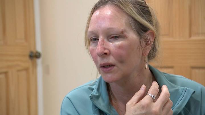 Latest victim of serial assaulter shares horrifying story