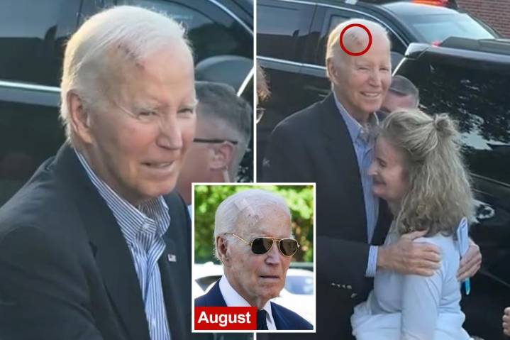 Joe Biden, 82, seen with massive head wound as former president's appearance sparks concern