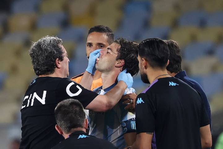 No puede comer. Sufre Racing: Santiago Sosa sufrió una fractura en el maxilar y se perderá  el desquite contra Flamengo