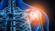 Volleyball coach undergoes rare double shoulder surgery at Chennai’s SRM Hospitals