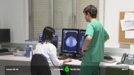 La AECC pide un protocolo unificado para detectar el cáncer de mama y denuncia retrasos generalizados en el diagnóstico