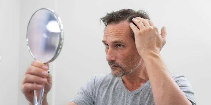 Qué tratamientos son realmente efectivos para frenar la caída del cabello