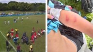 Árbitro agredido por jugadores y cuerpo técnico de América de Cali Sub-17 en el Torneo de las Américas está hospitalizado