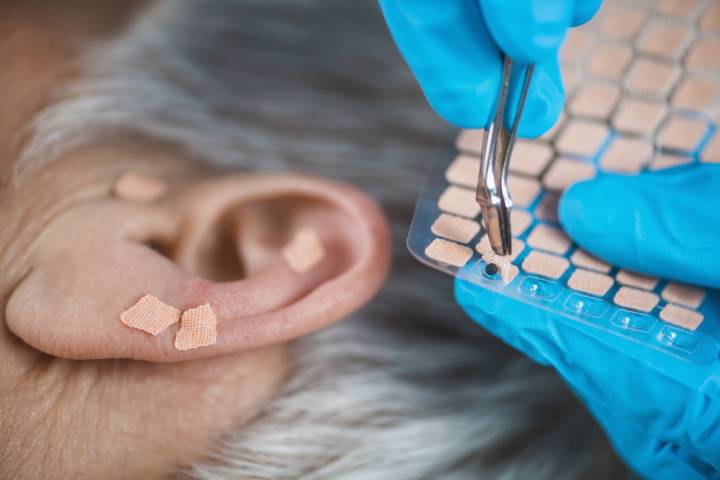 We Asked Doctors If Ear Seeding Actually Eases Stress and Muscle Pain. Here's the Verdict