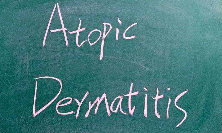 FDA Approves Zoryve Cream for Young Children with Atopic Dermatitis