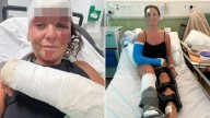 Dog walker’s life ‘ruined’ after hit-and-run crash leaves her with two broken legs
