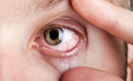 Chau cataratas: este el fruto seco que ayuda a prevenir los problemas de vista