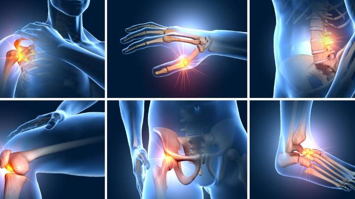 New arthritis treatment can last up to two years without surgery