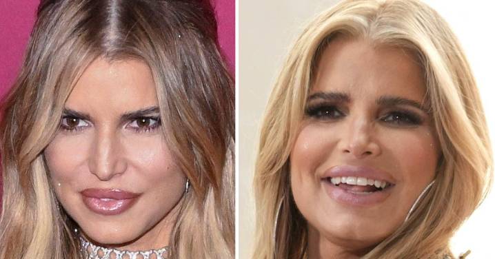 Jessica Simpson’s ‘Exaggerated' Face Fillers Explained By Plastic Surgeon