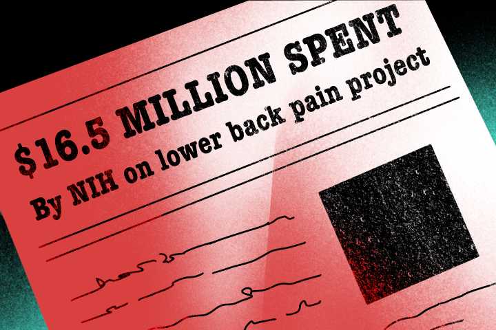 UMich receives $16.5 million grant to help treat chronic back pain