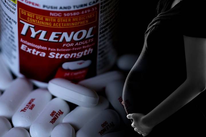 Trump’s Tylenol-and-autism speech will have serious consequences. I should know.