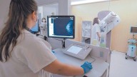 Una de cada cuatro mujeres canarias falta a los cribados de cáncer de mama