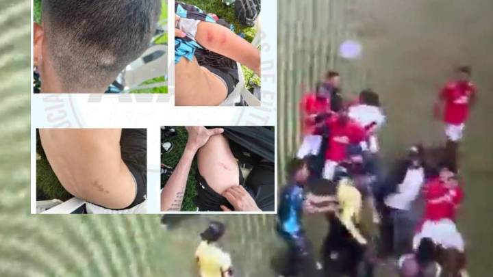 Violenta agresión a árbitro en Colombia: jugadores y técnicos del América Sub-17 golpearon al juez; ya hay pronunciamientos