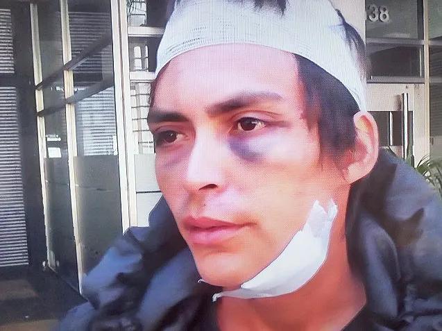 UN JOVEN RECIBIÓ UNA FEROZ GOLPIZA PROPINADA POR SUS PROPIOS FAMILIARES