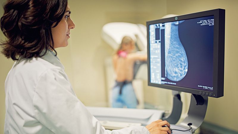 La detección precoz y la investigación, fundamentales para la supervivencia del cáncer de mama