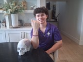 Scottsdale student over comes brain injury from playing football to coach team