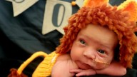 Louisville hospitals dress NICU babies in their first Halloween costumes