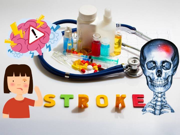 El vínculo entre el estrés y los accidentes cerebrovasculares