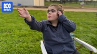 Only four people in Australia have been diagnosed with rare genetic disease CHOPS