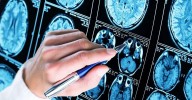 Descubren una proteína que previene el deterioro cerebral