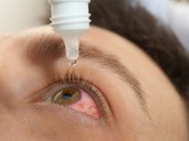 Riesgos de usar gotas para ojo rojo en exceso