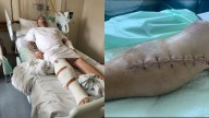 ‘I thought I was going to die’: Man shot, left for dead and even attacked by wombat in shocking bush ordeal