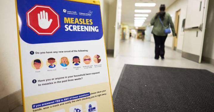 Canada is poised to lose its measles elimination status