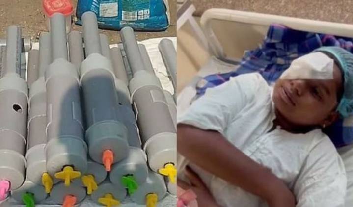 14 kids lose eyesight after playing with ‘Carbide Guns’ during Diwali in Madhya Pradesh