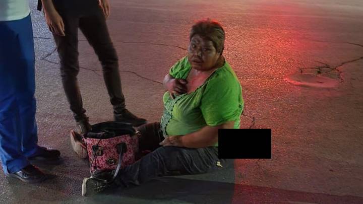 Atropellan a mujer en colonia San Isidro de Torreón; resultó gravemente lesionada y buscan a su familia