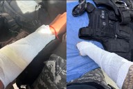 Agredió a su mamá de 78 y cuando fueron a detenerlo quemó a dos policías echándoles agua caliente
