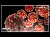 South Carolina reports more measles cases, many tied to Upstate outbreak