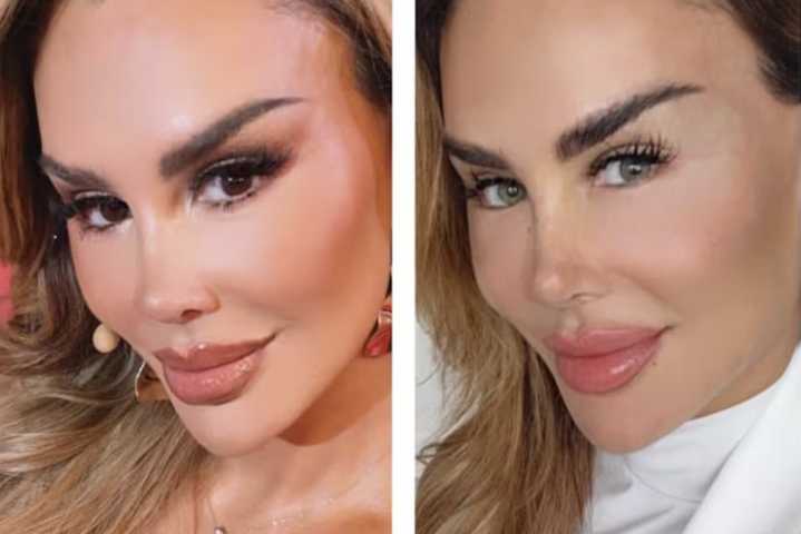 ¿Vale la pena cambiar el color de tus ojos? El peligro real detrás de la cirugía estética