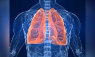Chest X-rays inadequate to detect asymptomatic TB among household contacts: The Lancet