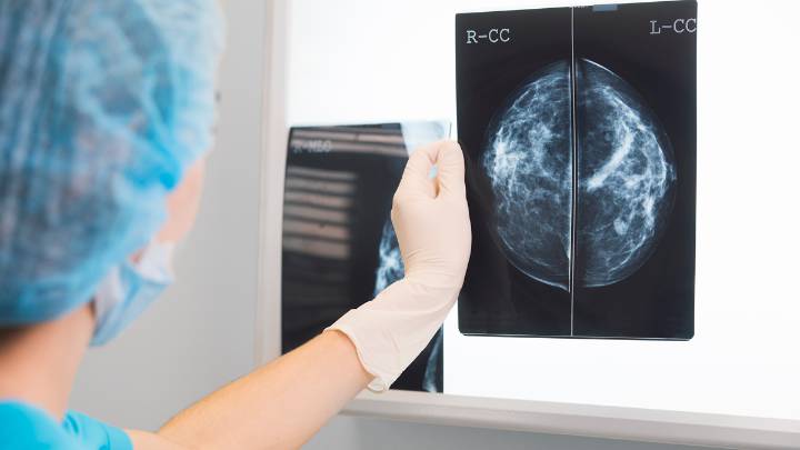 La Junta eleva a 2.317 mujeres las afectadas por los fallos en el cribado del cáncer de mama