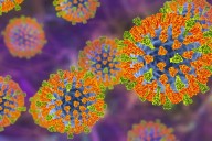 NZ may be on the cusp of another measles outbreak – what happened in 2019 should be a warning