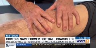 Atlanta doctors help save former Maryville football coach’s leg