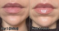 I Tried RoC's Lip Volumizer For A Month: An Honest Review