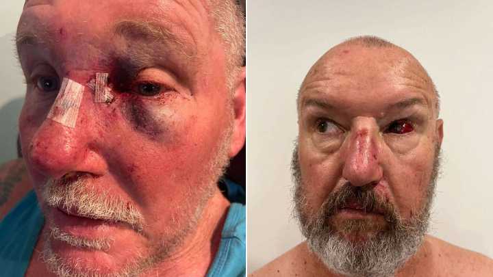 NSW prison officers walk off job after inmate avoids jail for brutal attack