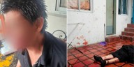 Violenta pelea entre vecinos en La Plata: se enfrentaron a cuchillazos y terminaron con el rostro desfigurado