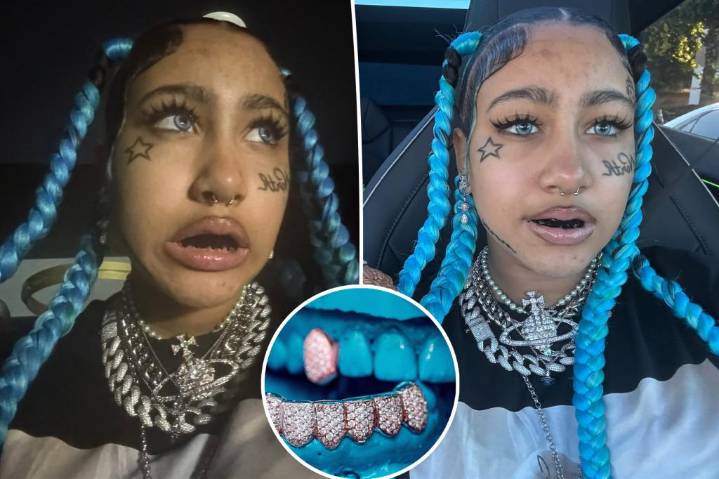 Dentists warn against viral TikTok trend