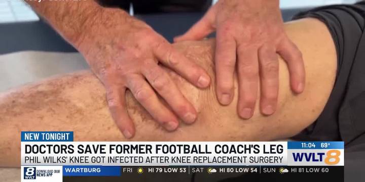 Atlanta doctors help save former Maryville football coach’s leg