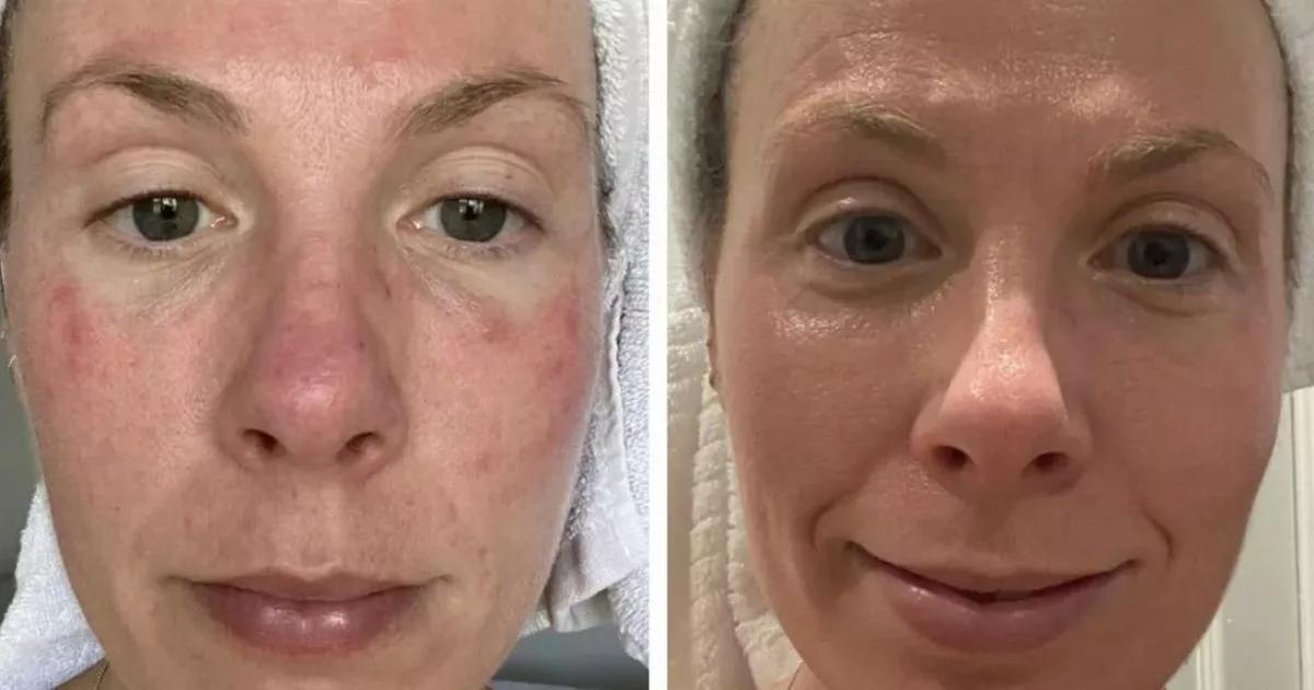 NHS doctor's multi-award-winning cream for mature skin 'takes just one use to work'